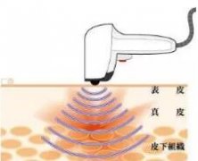 面部提升热拉提厂家报价热拉提价格