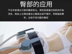 EMSCULPT美修斯磁波塑肌仪?emsculpt塑形仪哪里买