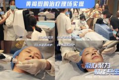 超皮秒机器多少钱一台？100万的皮秒仪器 _皮秒设备价格100万