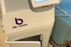 BB laser素颜光国内哪个生产厂家比较好？进口素颜光设备代理商